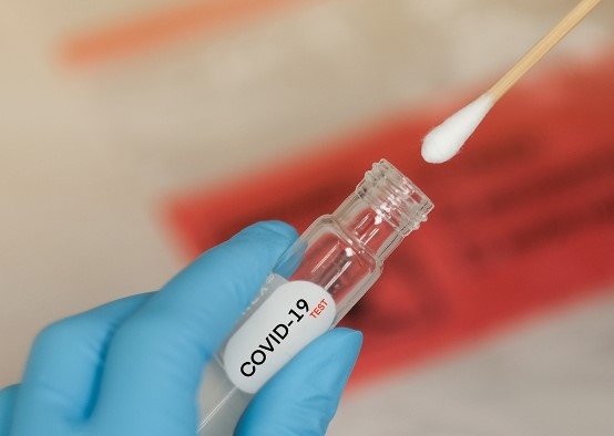 42 са новите случаи на коронавирус у нас Положителни са малко